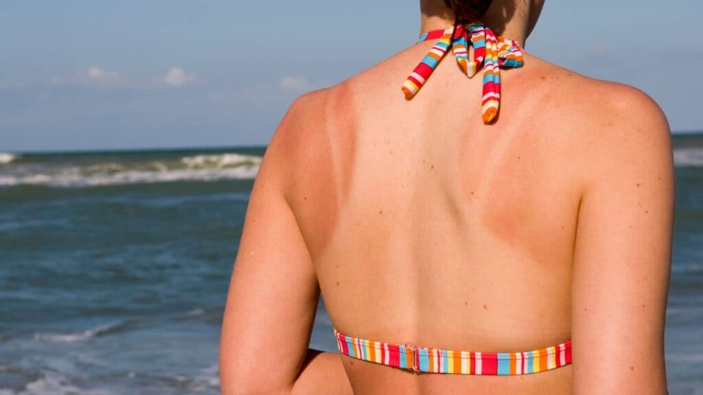 tan lines